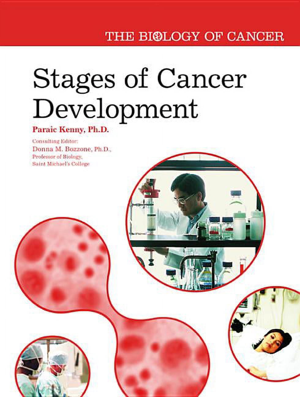 Cancer Development Published Biology of Cancer Stages of Cancer Development, (Hardcover) - Walmart.com