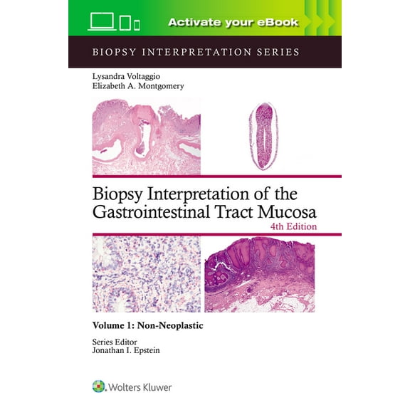 Biopsy Interpretation Biopsy Interpretation of the Gastrointestinal Tract Mucosa Volume 1: Non-Neoplastic: Print + eBook with Multimedia Volum, (Hardcover)