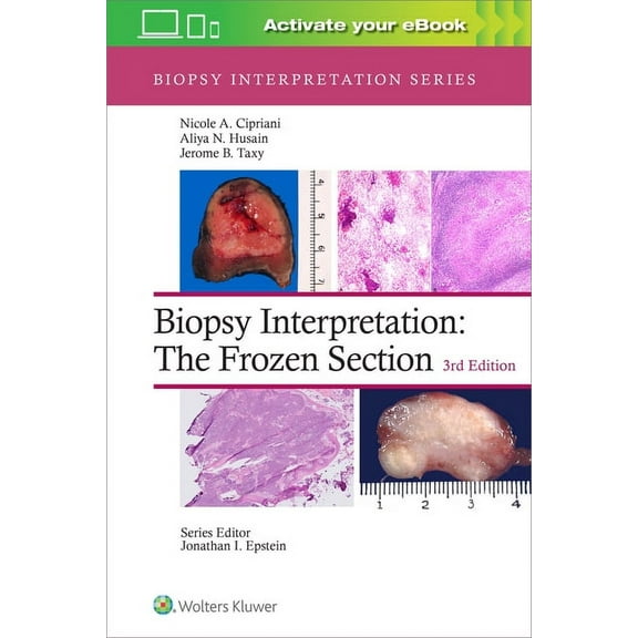Biopsy Interpretation Biopsy Interpretation: The Frozen Section: Print + eBook with Multimedia, (Hardcover)