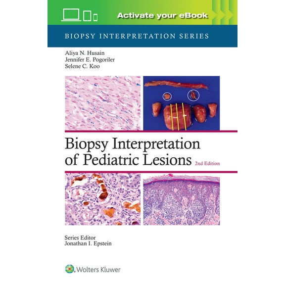 Biopsy Interpretation Biopsy Interpretation of Pediatric Lesions: Print + eBook with Multimedia, (Hardcover)