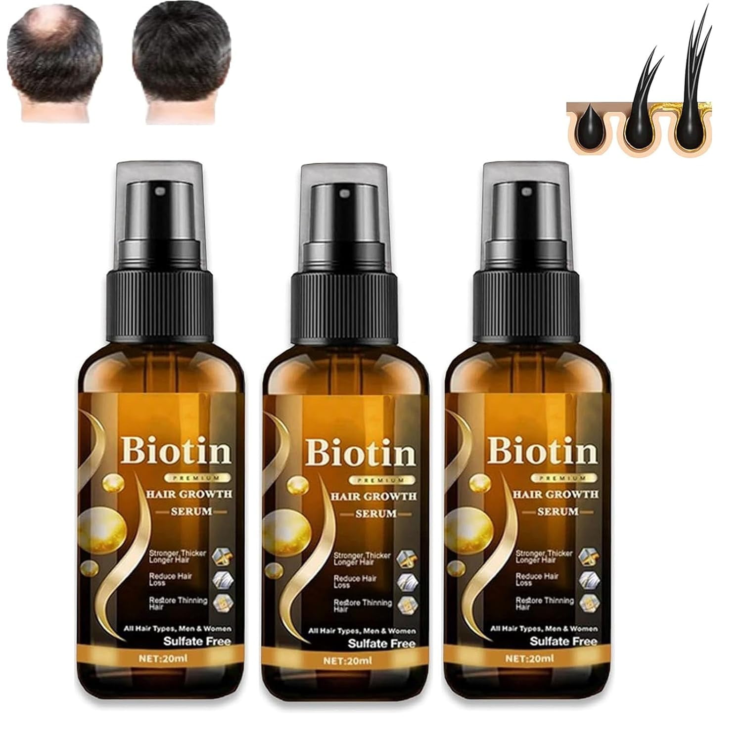 Biotin Hair Growth Spray, Ibealee Hair Regrowth Spray, Biotin