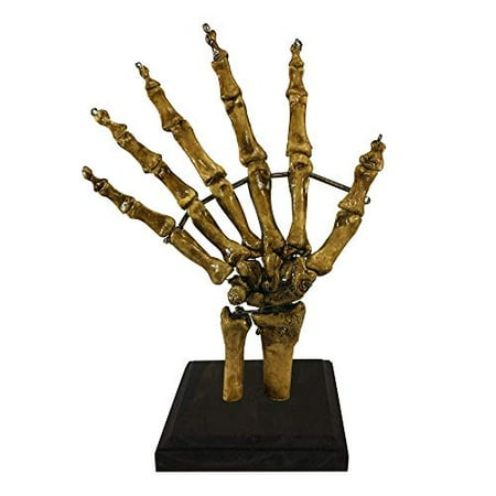 Bizarre! Vintage 6 Finger Skeleton Hand Oddity Medical Specimen