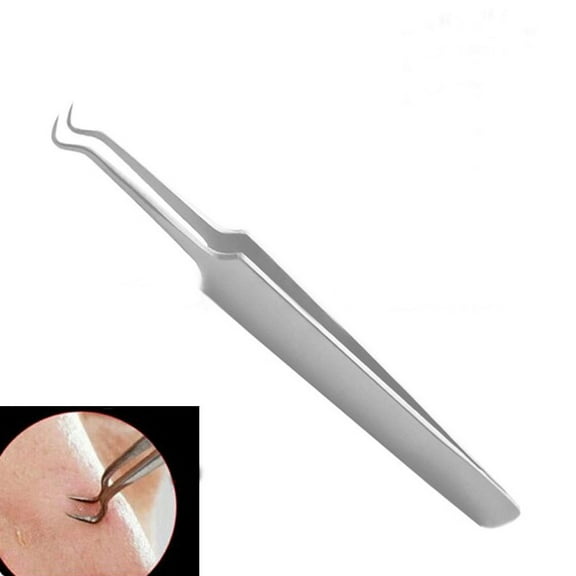 Blackhead Acne Pimple Clip Remover Tool-Best Curved Tool For Face Cleaner