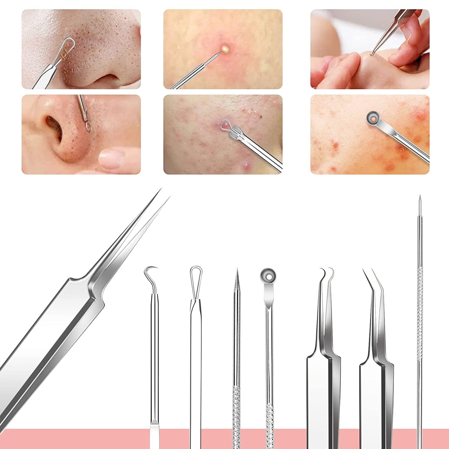 Blackhead Remover 8 Pcs Stainless Steel Pimple Popper Tool Kit Whitehead Blemish Removal Tool