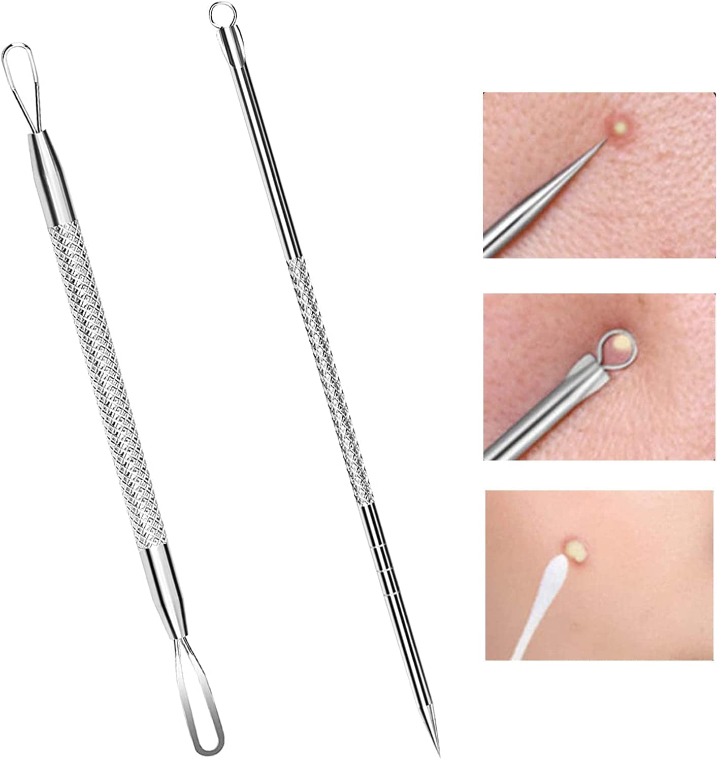 Blackhead Remover Comedone Extractor 2 PCS Pimple Popper Tool Pimple Comedone Removal 2 in 1 Extractor Tool Stainless Steel Pimple Extractor