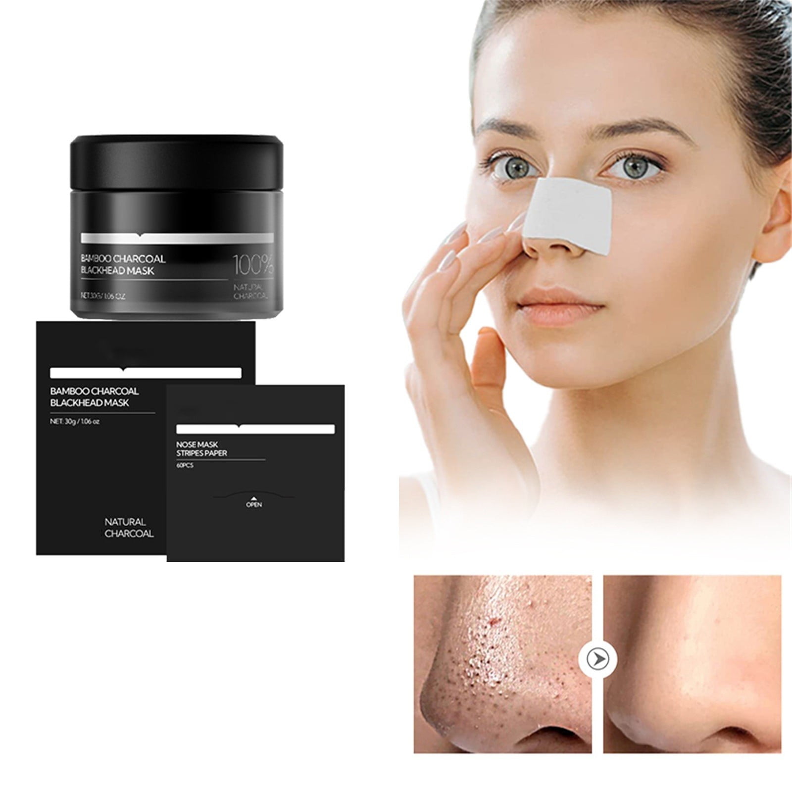 The Ultimate Guide To Big Blackhead Removal At Home - o8iuktm