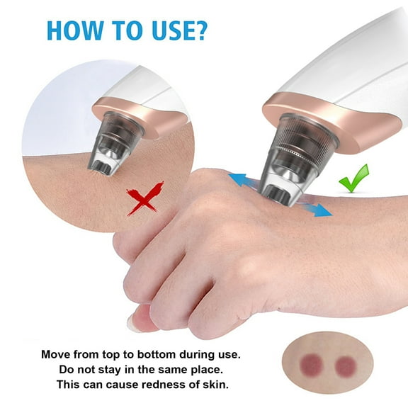 Blackhead Remover,Pore Cleaner Portable Suction 5-in-1 Remover 5 Probes Pore 5-in-1 With Lcd Cosmetic Lcd Pore Remover Lcd Display Probes Pore Remover With Suction Remover Display Remover