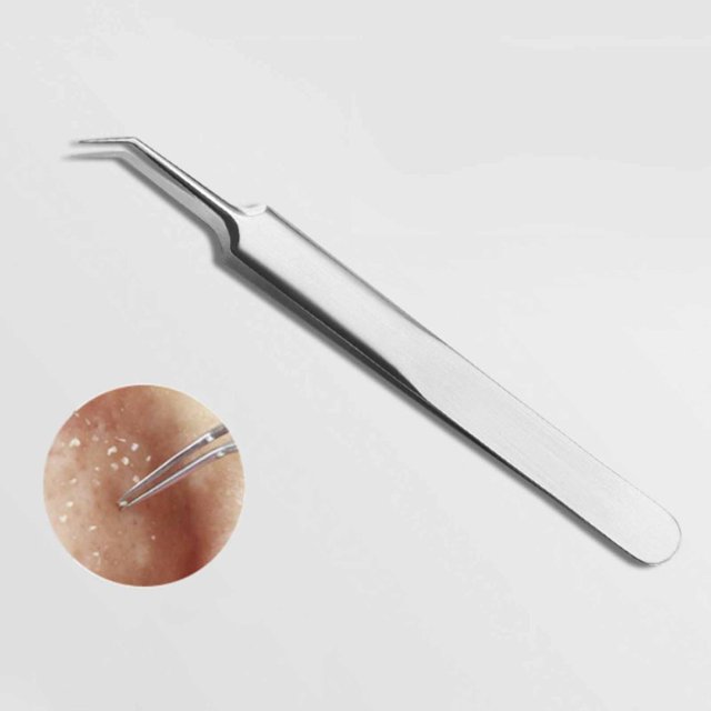 Blackhead Remover Tweezers Whitehead Comedone Pimple Popping Extractor