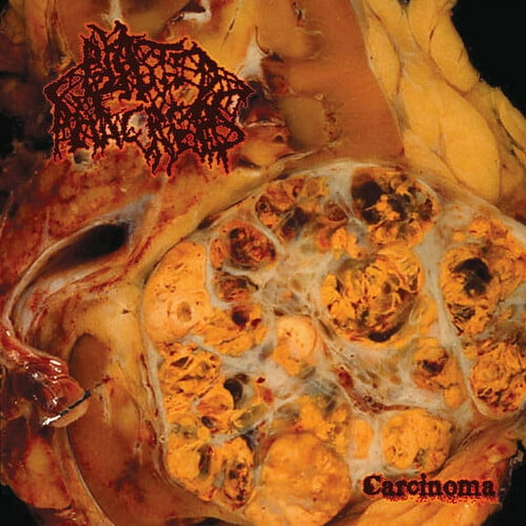 Blasted Pancreas - Carcinoma - Music & Performance - CD