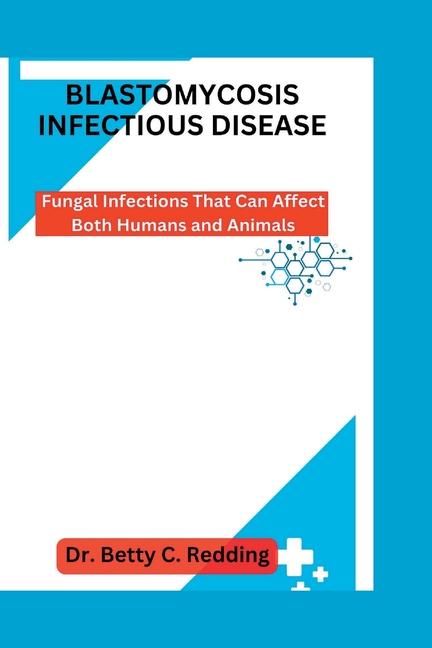 Blastomycosis Infectious Disease: Fungal Infections That Can Affect ...