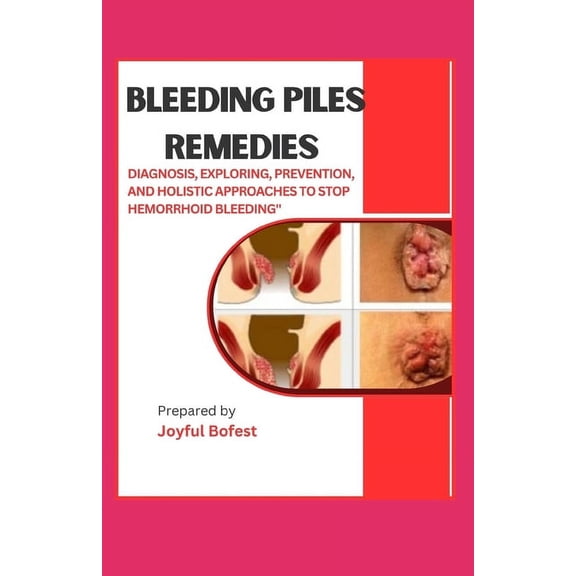 Bleeding Piles Remedies: "Diagnosis, Exploring Prevention, and Holistic Approaches to Stop Hemorrhoid Bleeding" (Paperback)