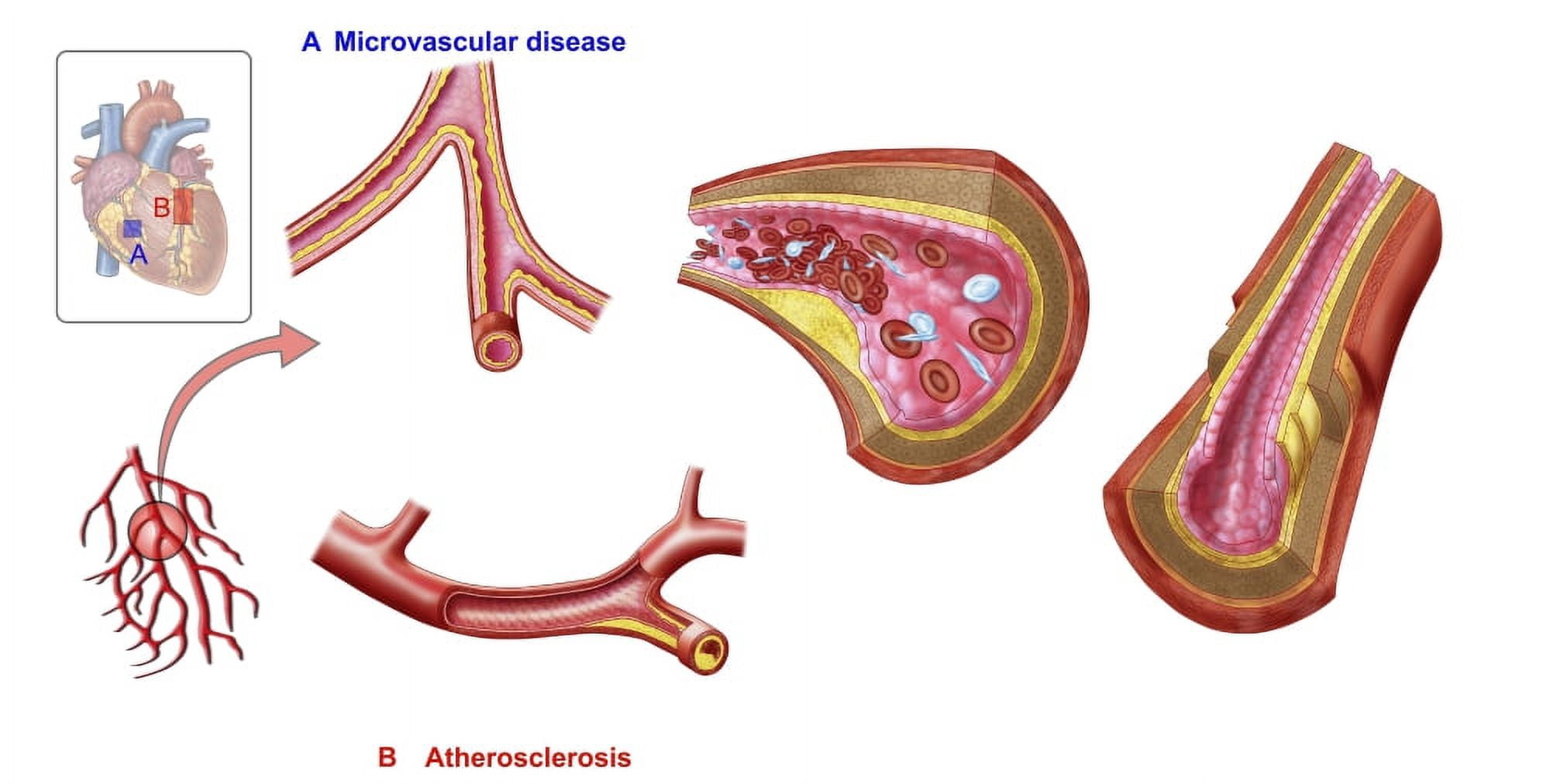 Blood vessel anatomy Canvas Art - Stocktrek Images (20 x 11)