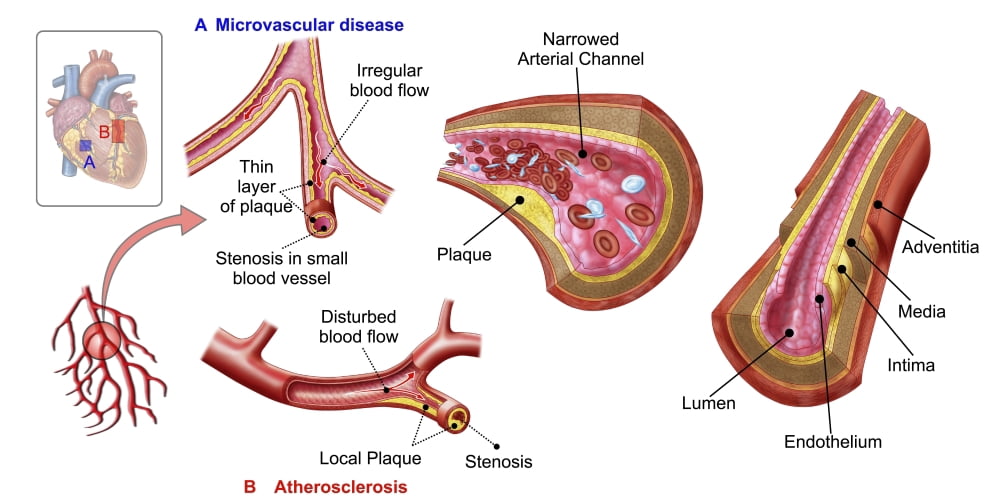 Blood vessel anatomy Canvas Art - Stocktrek Images (40 x 21)