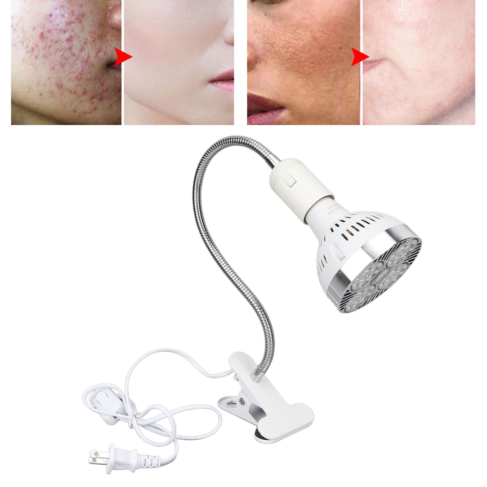 Blue Light Light, 460nm Wavelength Easy Absorbed LED Blue Device Remove