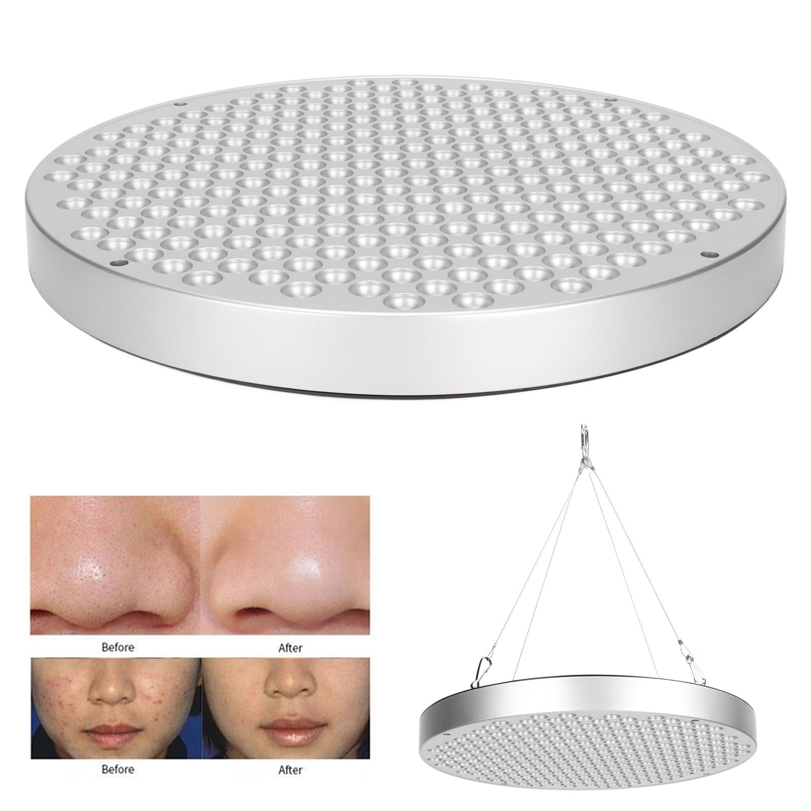 Blue Light Massage Lamp, Household Baby Jaundice Lamp Skin Care Tool