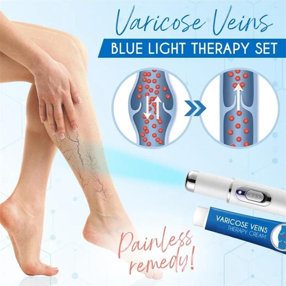 Blue Light Therapy Varicose Veins Pen/Cream Soft Scar Removal Set