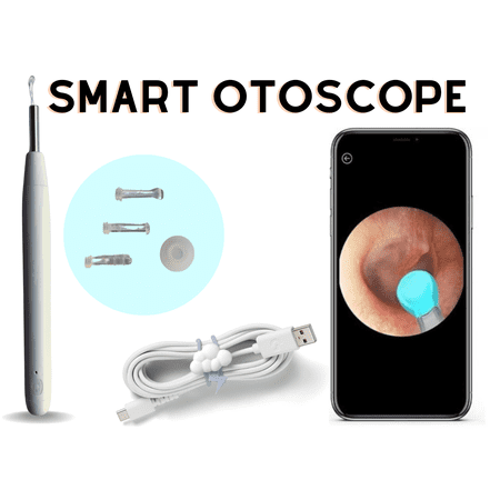 Bluetooth Enabled Otoscope: High-Definition Ear Inspection Tool with Wireless Connectivity