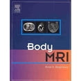 thumbnail image 1 of Body MRI (Hardcover) by Evan S Siegelman, 1 of 1