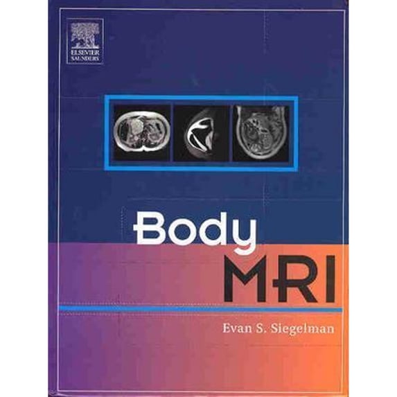 Body MRI (Hardcover) by Evan S Siegelman