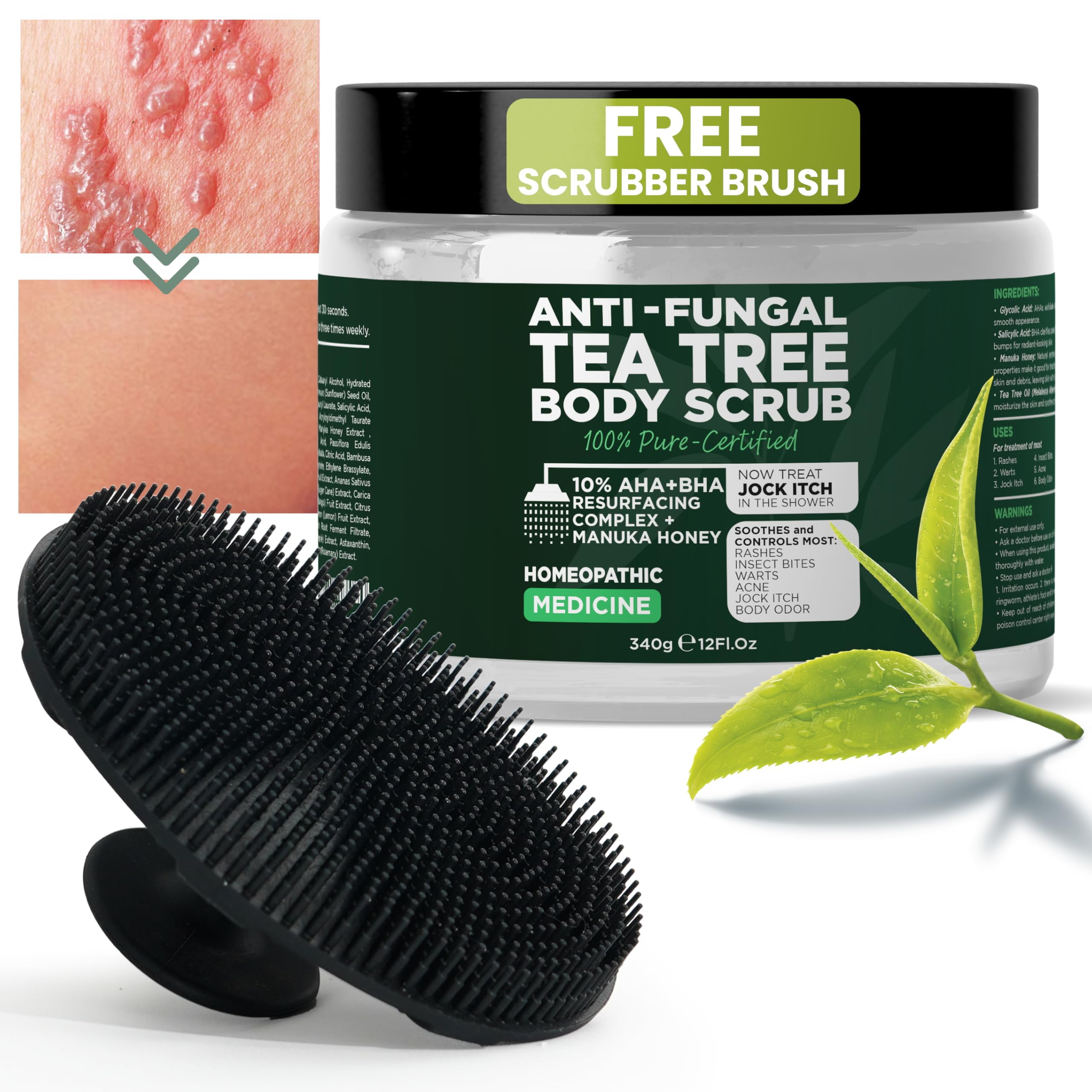 Body Scrub Exfoliator, Antifungal Soap with Tea Tree Oil, Salicylic Acid & Glycolic Acid Body