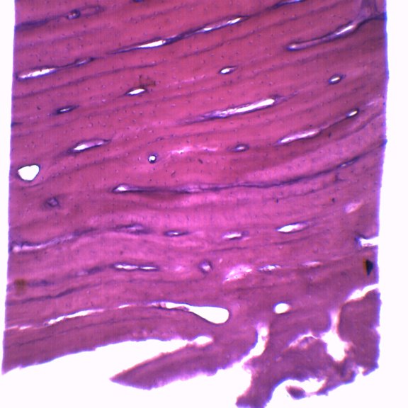 Bone - Cross Section & Longitudinal Section - Prepared Microscope Slide - 75 x 25mm - Biology & Microscopy - Eisco Labs