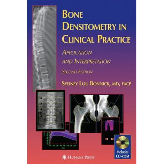 Pre-Owned Bone Densitometry in Clinical Practice: Application and Interpretation (Hardcover) by Sydney Lou Bonnick