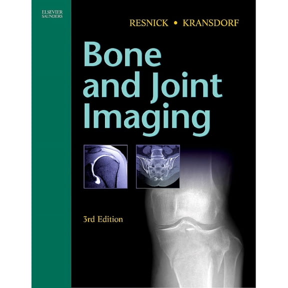 Pre-Owned Bone and Joint Imaging