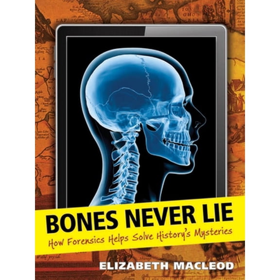Pre-Owned Bones Never Lie: How Forensics Helps Solve History's Mysteries (Paperback) 1554514827 9781554514823