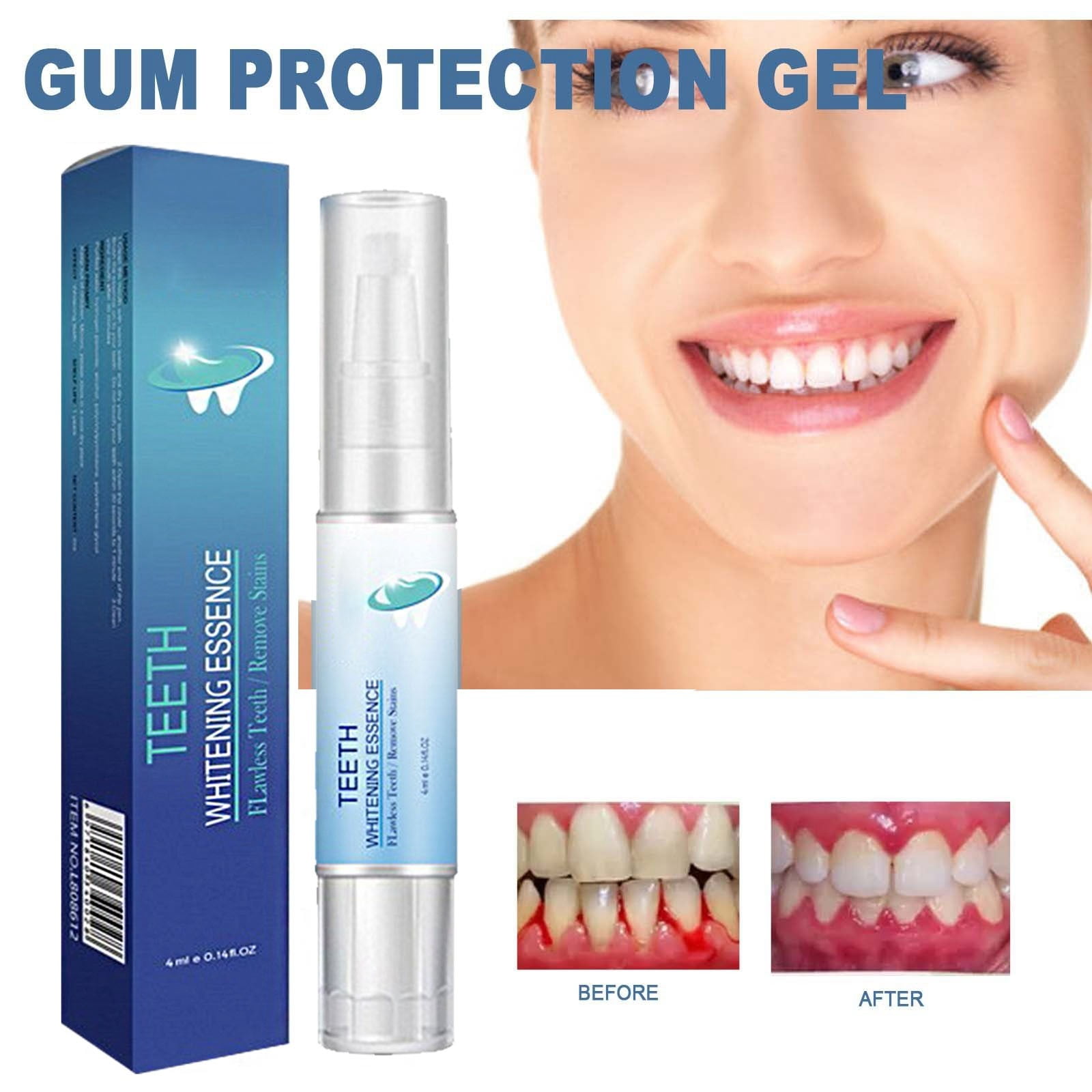 Brace Toothbrush Temp Tooth Filling Restoring Toothpaste Closest