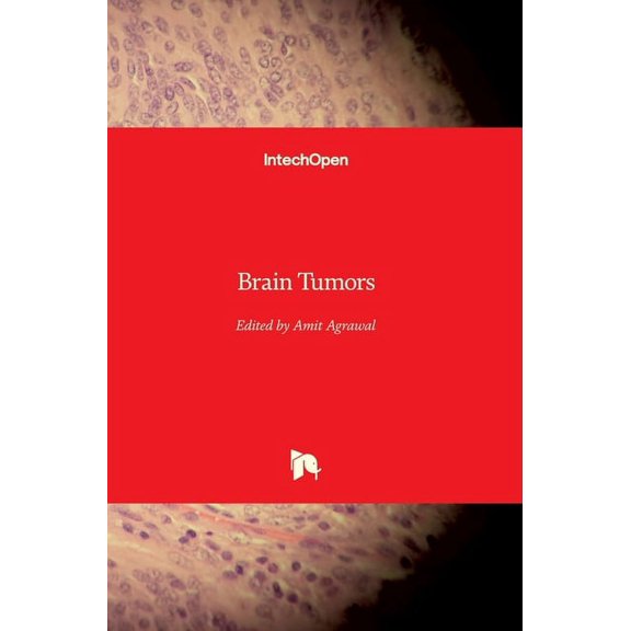 Brain Tumors (Hardcover)