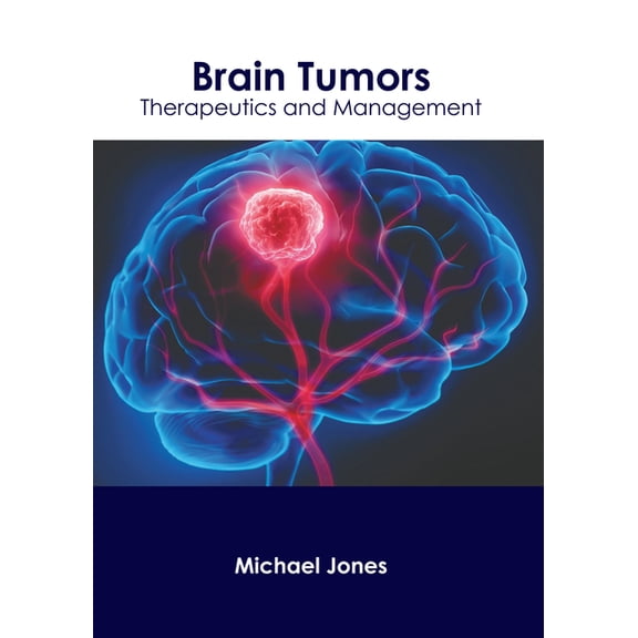 Brain Tumors: Therapeutics and Management, (Hardcover)