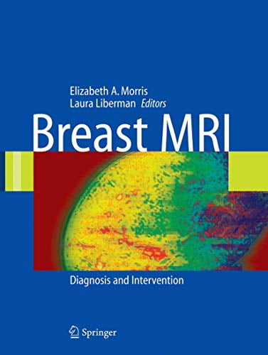 Pre-Owned Breast MRI: Diagnosis and Intervention, 9780387219974, 0387219978, Hardcover, 2005 edition