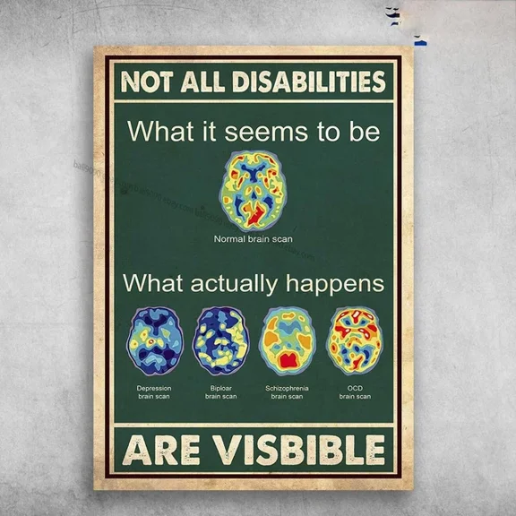 Brian Scan - Not All Disabilities What It Seems To Be Normal Brain Scan Wall Art