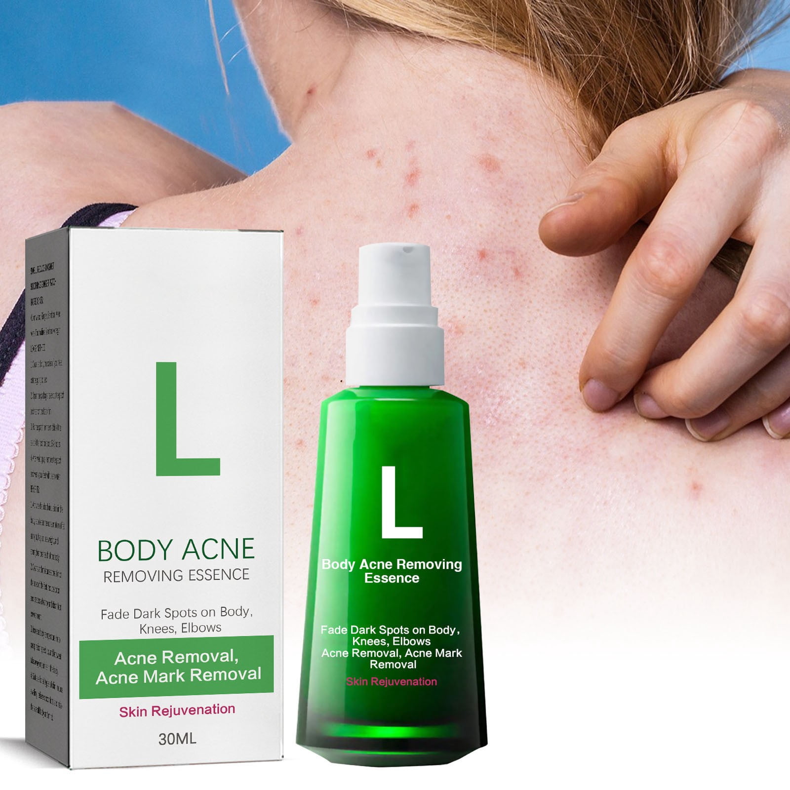 Brightening & Blemish-Reducing Serum – Dark Spot Corrector & Skin