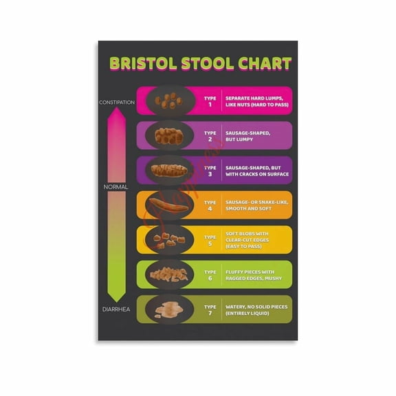 Bristol Stool Chart Poster Digestive Health Bowel Movement Guide (6) Canvas for Living Room Bedroom Decor