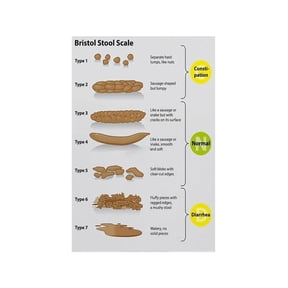 Bristol Stool Scale Poster Digestive System Health Chart Medical Reference Guide for Clinic Office Home Health Education