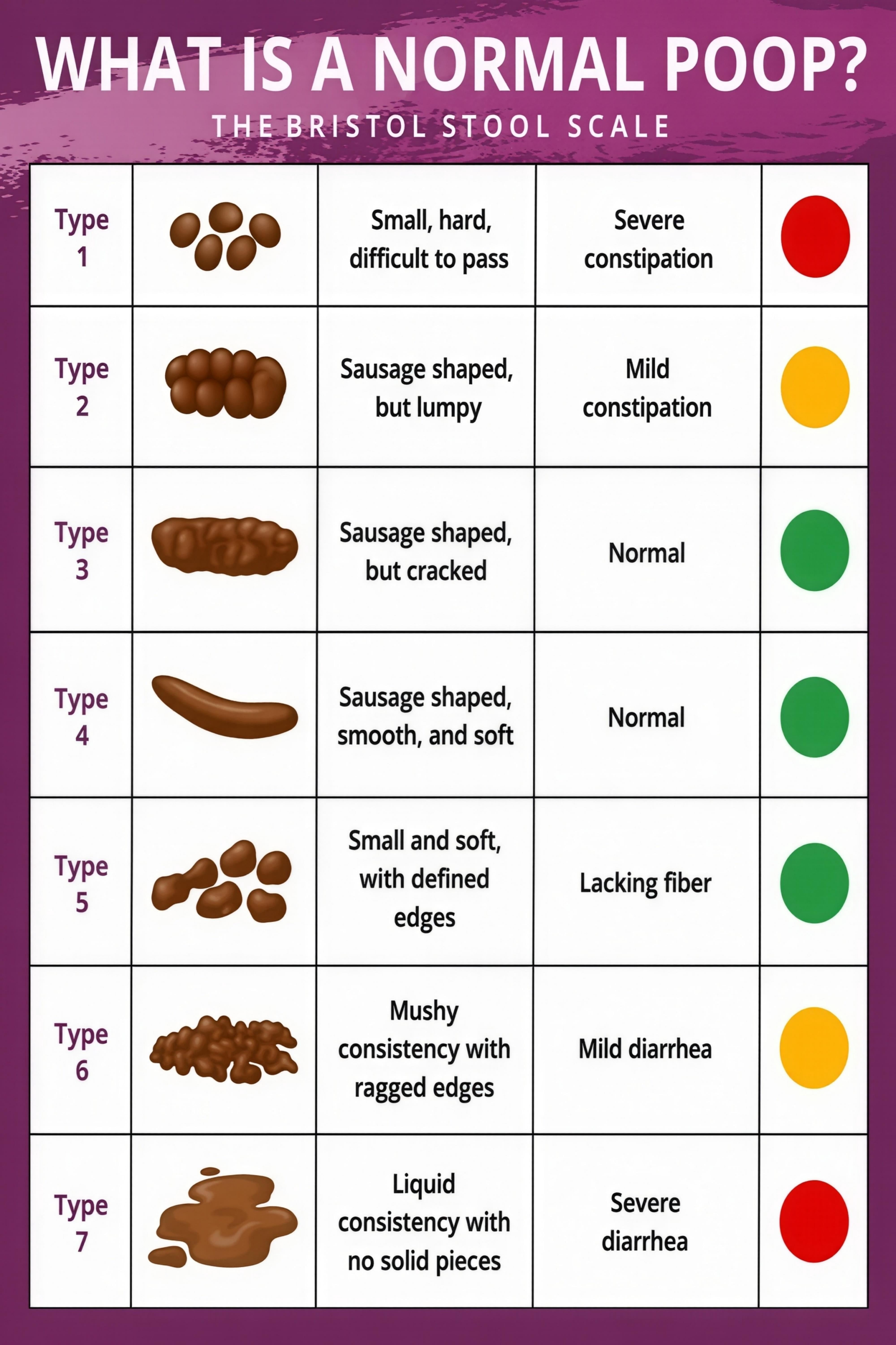 Bristol Stool Types Reference Chart for Study Room Classroom Decor ...