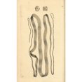 thumbnail image 1 of Broad Tapeworm, Diphyllobothrium Latum Poster Print By ® Florilegius Mary Evans (18 X 24), 1 of 3