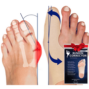 Bunion Bootie Ultra-Thin Bunion Corrector Sleeve for Women & Men, Shoe-Friendly, Breathable - XLarge-Left