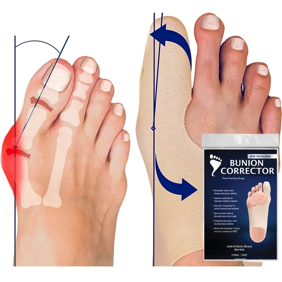 Bunion Bootie Ultra-Thin Bunion Corrector Sleeve for Women & Men, Shoe-Friendly, Breathable - Medium-Left