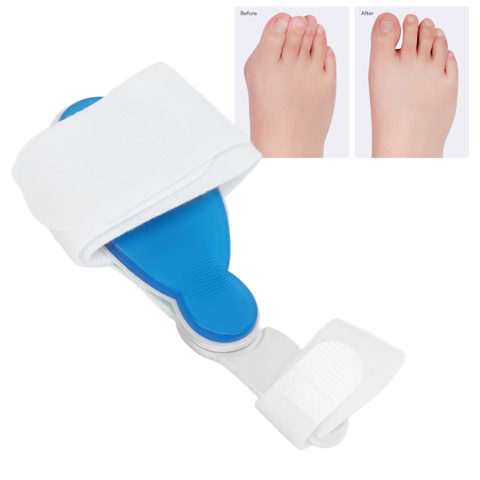 Bunion Corrector Orthopedic, Bunion Splint Hardened Gel Gasket Big Toe