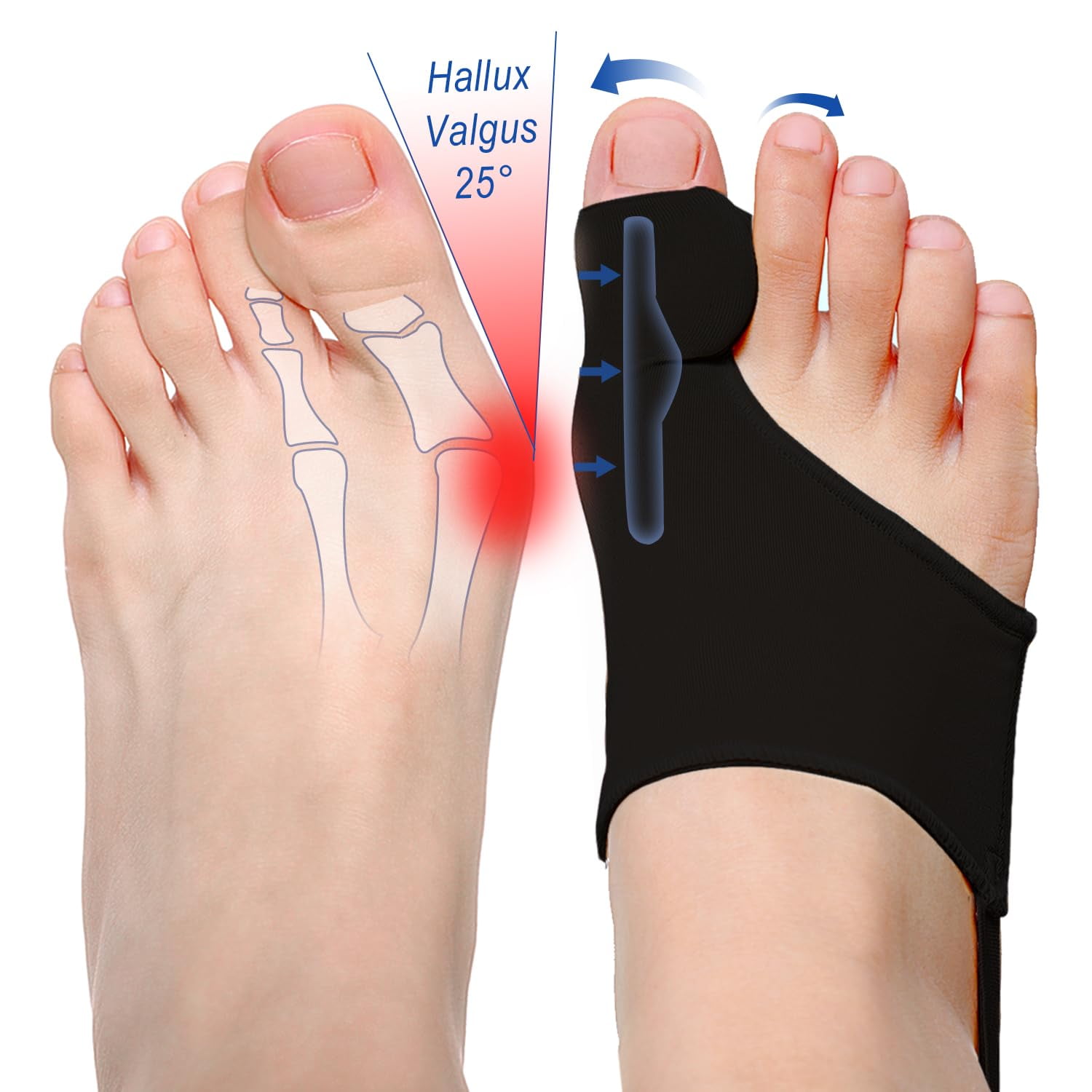 Bunion Corrector for Women/Man Big Toe Straightener Bunion Corrector, Relief splints Reduce Pain and Correct Toe Alignment, Brace Day/Night, fit for R/L,Washable(Black 2-Pack)