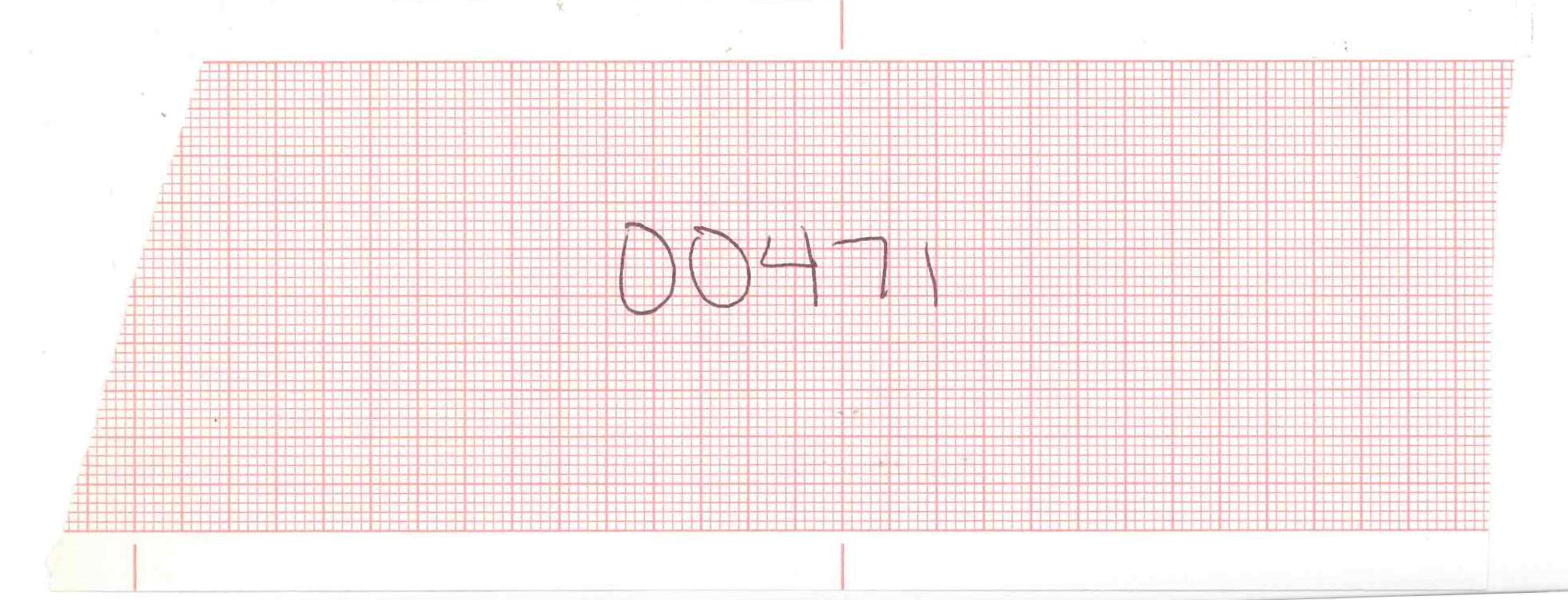 Burdick 007941 EMG Chart Paper, Red Grid, 63mm X 45m (10 Rolls)