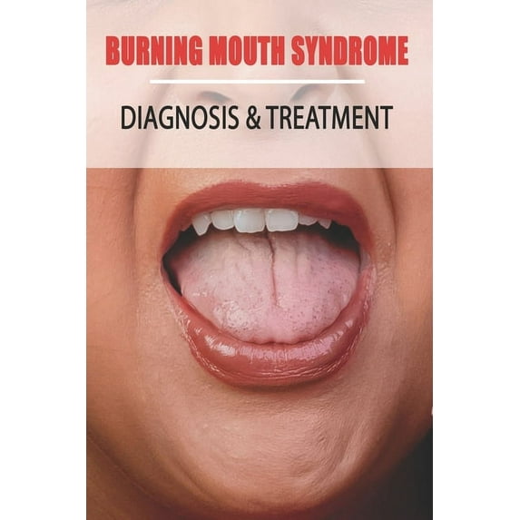 Burning Mouth Syndrome: Diagnosis & Treatment: Burning Mouth Syndrome Guide, (Paperback)
