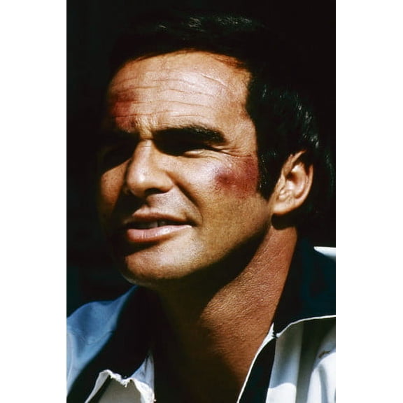 Burt Reynolds close up portrait bruised face 24x36 Poster