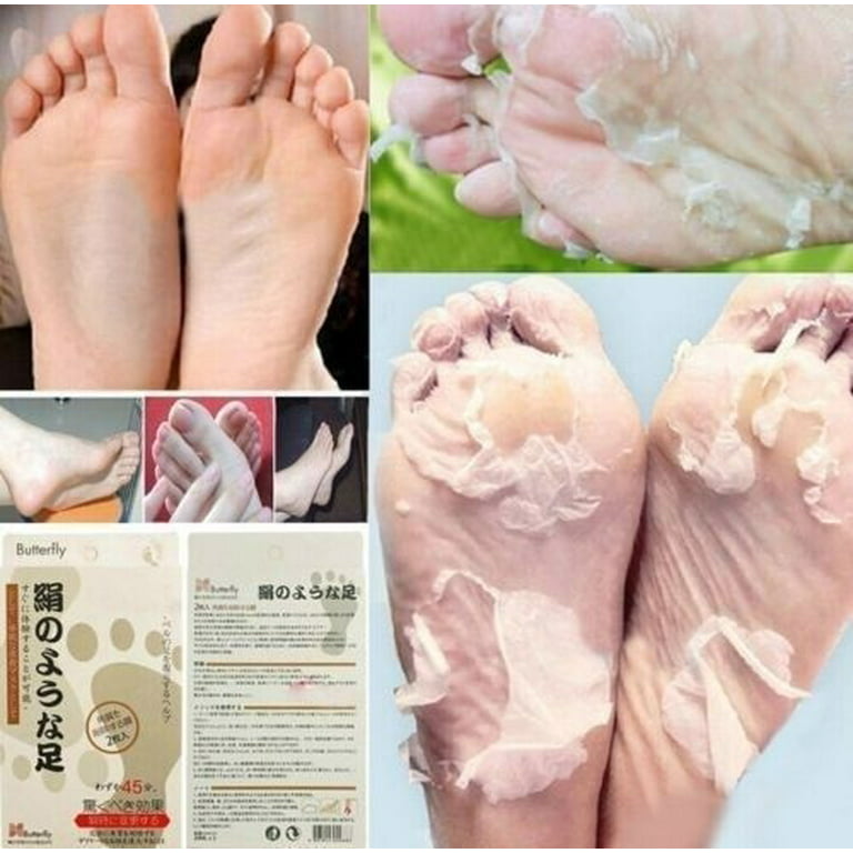 Gotyou Papaya Hot Remove Dead Skin Foot Mask Peeling Cuticles Heel Feet  Care Anti Aging 
