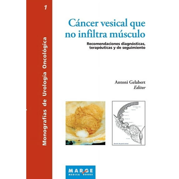 Cáncer vesical que no infiltra músculo: Recomendaciones diagnósticas, terapéuticas y de seguimiento, (Paperback)