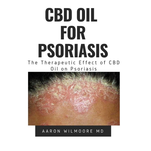 CBD Oil for Psoriasis All You Need To Know About How CBD OIL WORKS