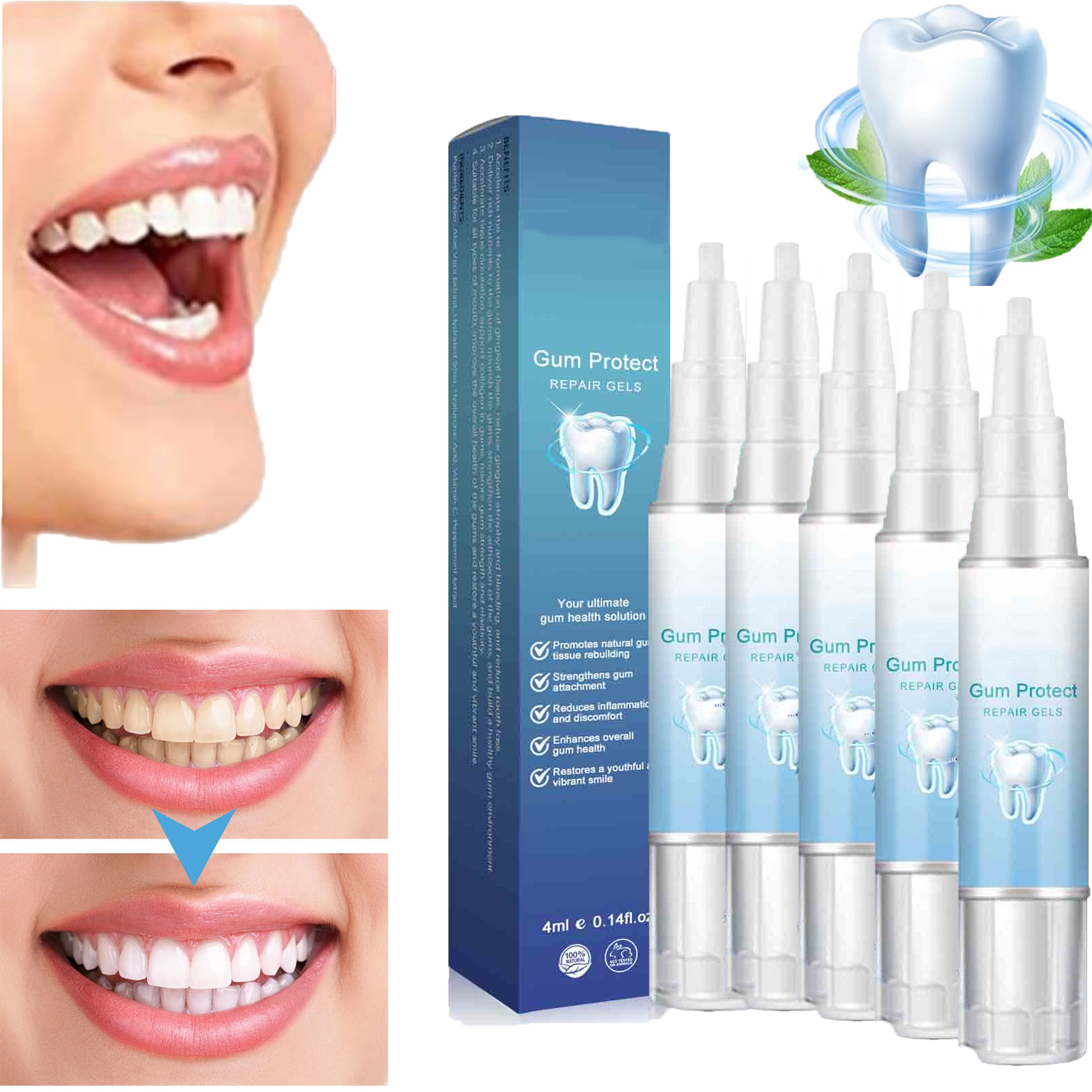 CELNNCOE Teeth Whitening Pen for Teeth Whitening, Teeth Whitening Kit