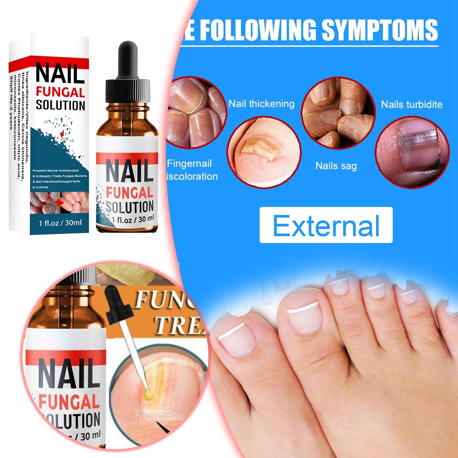 CENGZISHU 30ml Nail Solution Hand Foot And Nail Nail Solution Thickens And Softs Nails Extra